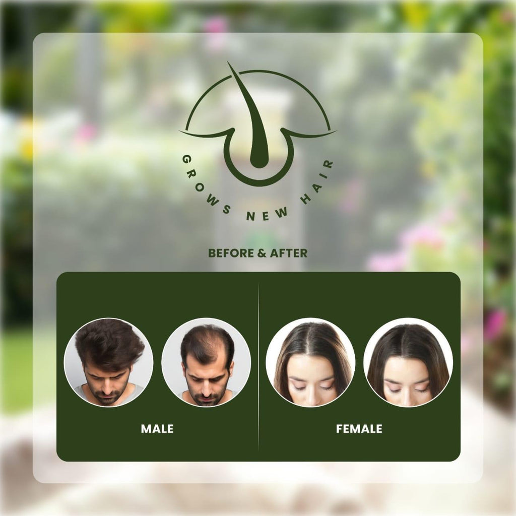 Saira'z Ultimate Hair Growth & Shine Oil | Stop Hair Fall Naturally (Free Delivery)