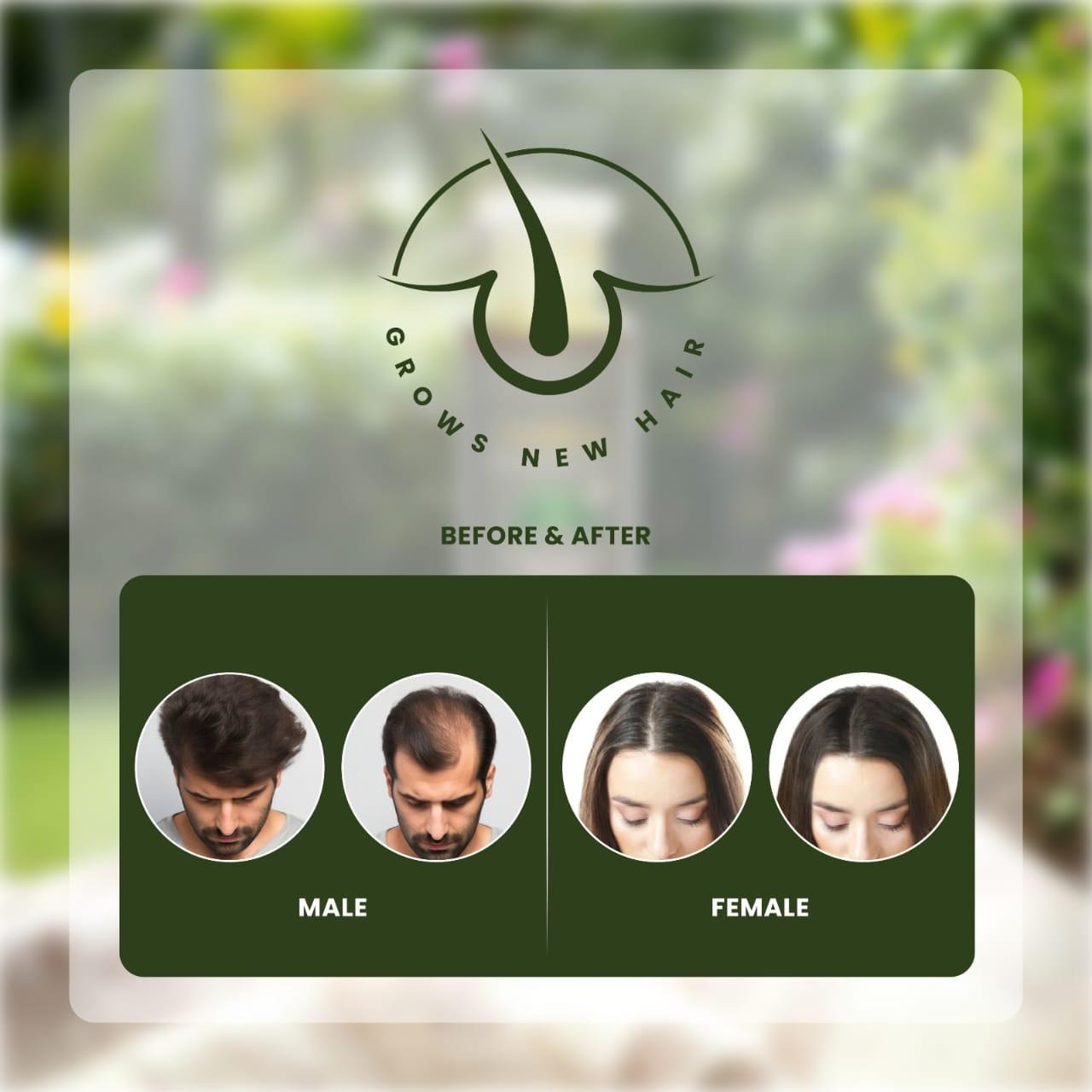 Saira'z Ultimate Hair Growth & Shine Oil | Stop Hair Fall Naturally (Free Delivery)